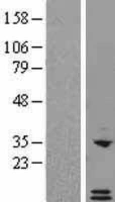 Western Blot: CXCL6/GCP-2 Overexpression Lysate [NBL1-09629]