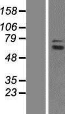 Western Blot: GCP4 Overexpression Lysate [NBP2-10319]