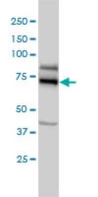 Western Blot: GCR2 Antibody (1A11) [H00011319-M01]