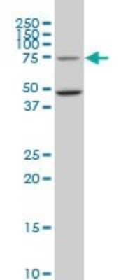 Western Blot: GCR2 Antibody (1E5) [H00011319-M02]