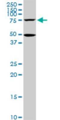 Western Blot: GCR2 Antibody (1E5) [H00011319-M02]