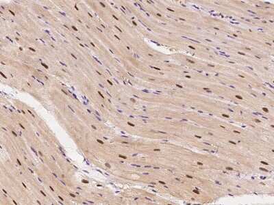 Immunohistochemistry-Paraffin: GCR2 Antibody [NBP2-99443]