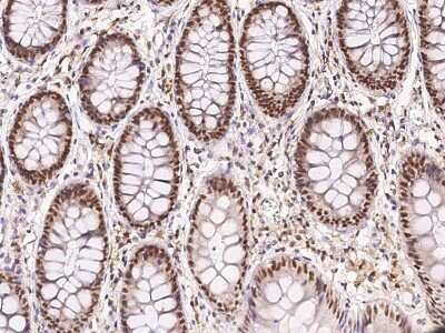 Immunohistochemistry-Paraffin: GCR2 Antibody [NBP2-99443]