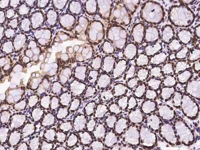 Immunohistochemistry-Paraffin: GCR2 Antibody [NBP2-99443]