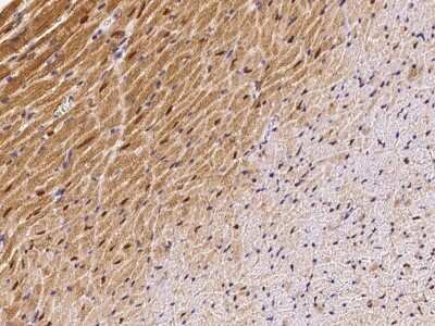 Immunohistochemistry-Paraffin: GCR2 Antibody [NBP2-99443]