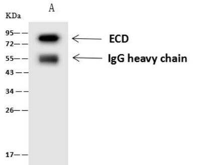 Immunoprecipitation: GCR2 Antibody [NBP2-97163]