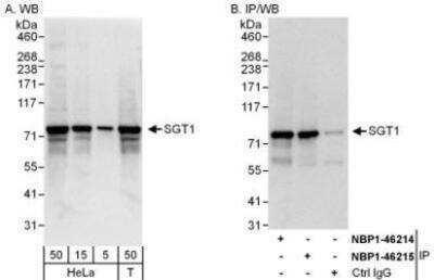 Western Blot: GCR2 Antibody [NBP1-46214]