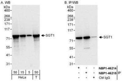 Western Blot: GCR2 Antibody [NBP1-46215]