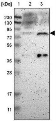 Western Blot: GCR2 Antibody [NBP2-33278]