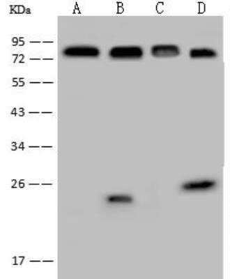 Western Blot: GCR2 Antibody [NBP2-97163]