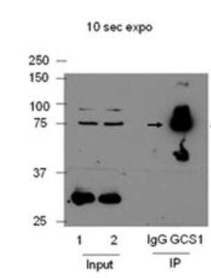 Immunoprecipitation: GCS1 Antibody [NBP2-14967]