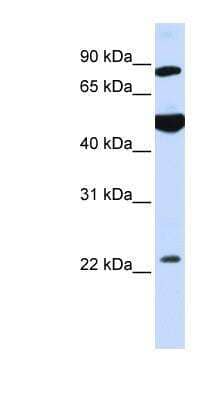 Western Blot: GCS1 Antibody [NBP1-79194]