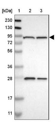 Western Blot: GCS1 Antibody [NBP1-81839]