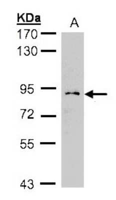 Western Blot: GCS1 Antibody [NBP2-14967]