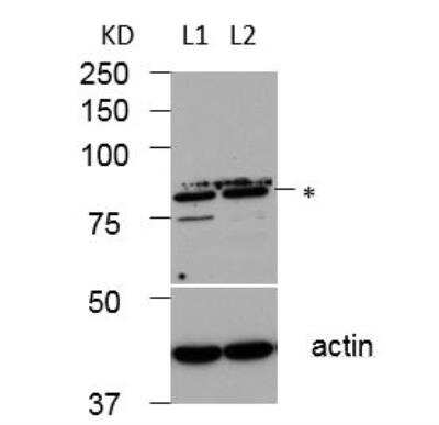 Western Blot: GCS1 Antibody [NBP2-14967]