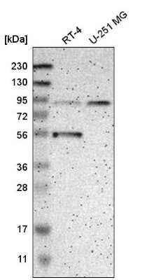 Western Blot: GCS1 Antibody [NBP2-58996]