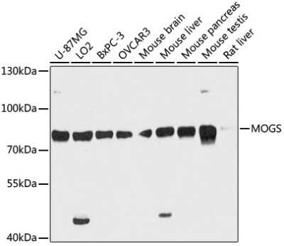 Western Blot: GCS1 AntibodyAzide and BSA Free [NBP3-03774]