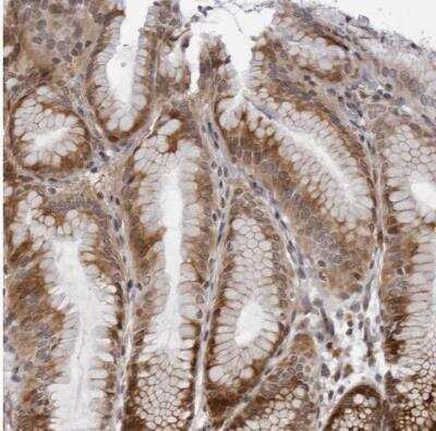 Immunohistochemistry-Paraffin: GCSAML Antibody [NBP1-81894]