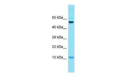 Western Blot: GCSAML Antibody [NBP2-84961]