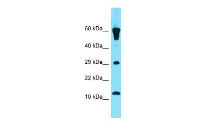 Western Blot: GCSAML Antibody [NBP2-84962]