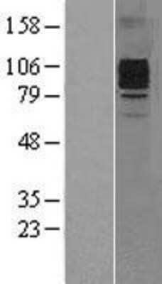 Western Blot: G-CSFR/CD114 Overexpression Lysate [NBL1-09520]