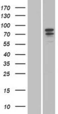 Western Blot: G-CSFR/CD114 Overexpression Lysate [NBP2-05218]