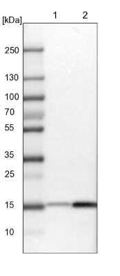 Western Blot: GCSH Antibody [NBP1-85842]