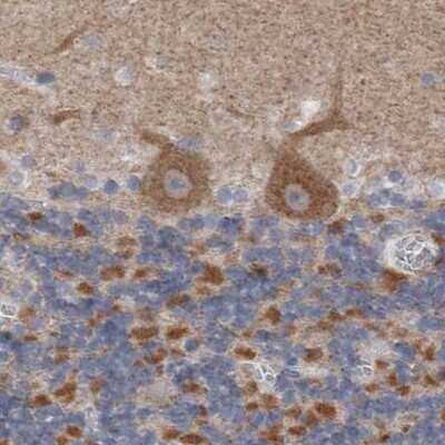 Immunohistochemistry-Paraffin: GDAP1 Antibody [NBP1-84429]