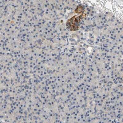 Immunohistochemistry-Paraffin: GDAP1 Antibody [NBP1-84430]