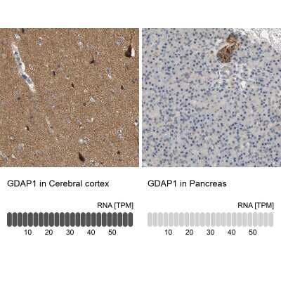 Immunohistochemistry-Paraffin: GDAP1 Antibody [NBP1-84430]