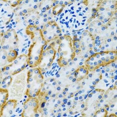 Immunohistochemistry-Paraffin: GDAP1 Antibody - BSA Free [NBP3-04549]