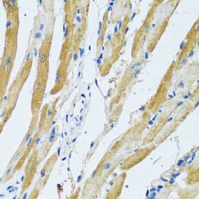 Immunohistochemistry-Paraffin: GDAP1 Antibody - BSA Free [NBP3-04549]