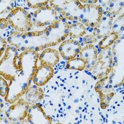 Immunohistochemistry-Paraffin: GDAP1 Antibody - BSA Free [NBP3-04549]