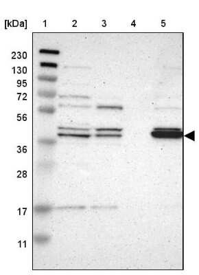 Western Blot: GDAP1 Antibody [NBP1-84430]