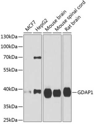 Western Blot: GDAP1 AntibodyBSA Free [NBP3-04549]