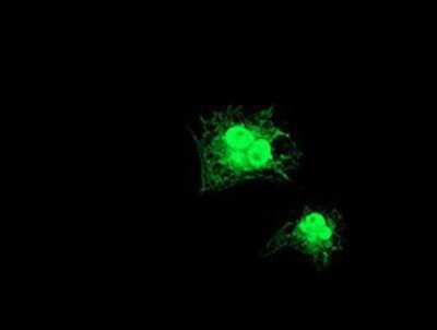 Immunocytochemistry/ Immunofluorescence: GDAP1L1 Antibody (OTI1G5) [NBP2-00946]