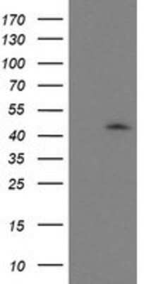 Western Blot: GDAP1L1 Antibody (OTI1G5) [NBP2-00946]