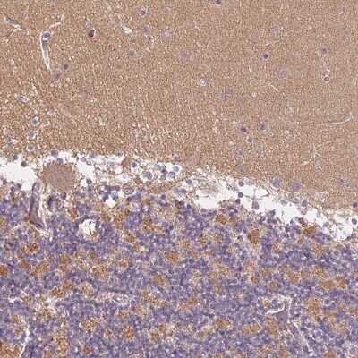 Immunohistochemistry: GDAP1L1 Antibody [NBP2-49390]