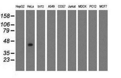 Western Blot: GDAP1L1 Antibody (OTI1G5)Azide and BSA Free [NBP2-72182]