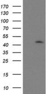 Western Blot: GDAP1L1 Antibody (OTI1G5)Azide and BSA Free [NBP2-72182]