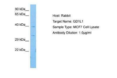 Western Blot: GDAP1L1 Antibody [NBP2-84966]