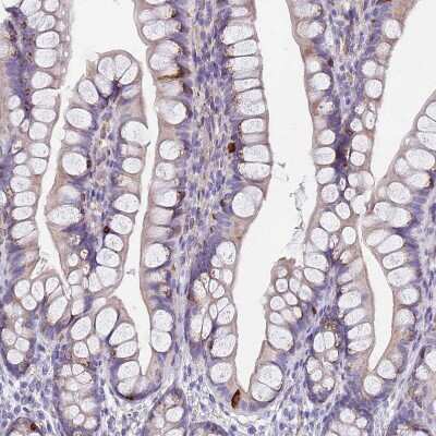 Immunohistochemistry-Paraffin: GDAP2 Antibody [NBP1-91932]