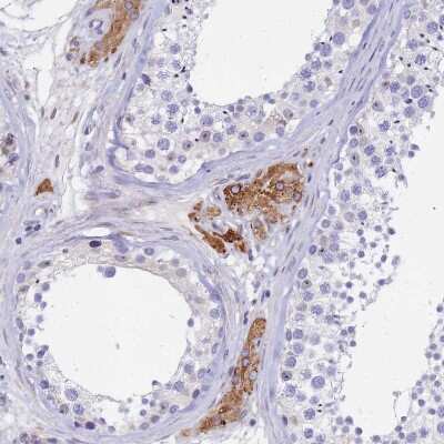 Immunohistochemistry-Paraffin: GDAP2 Antibody [NBP1-91932]
