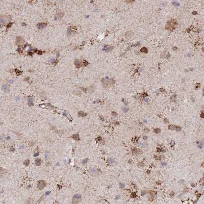 Immunohistochemistry-Paraffin: GDAP2 Antibody [NBP1-91932]