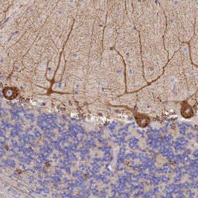 Immunohistochemistry-Paraffin: GDAP2 Antibody [NBP1-91932]
