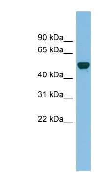 Western Blot: GDAP2 Antibody [NBP1-57713]