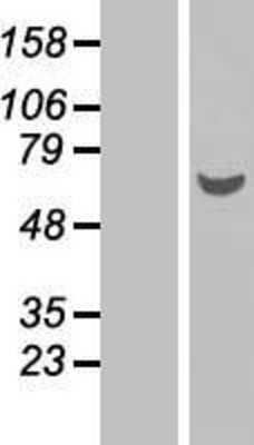 Western Blot: GDAP2 Overexpression Lysate [NBP2-06937]