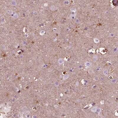 Immunohistochemistry-Paraffin: GDF-11/BMP-11 Antibody [NBP2-57399]