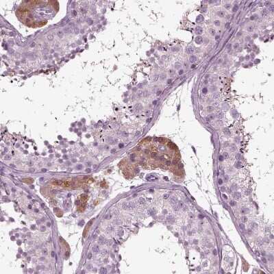Immunohistochemistry-Paraffin: GDF-11/BMP-11 Antibody [NBP2-57399]