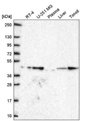 Western Blot: GDF-11/BMP-11 Antibody [NBP2-57399]